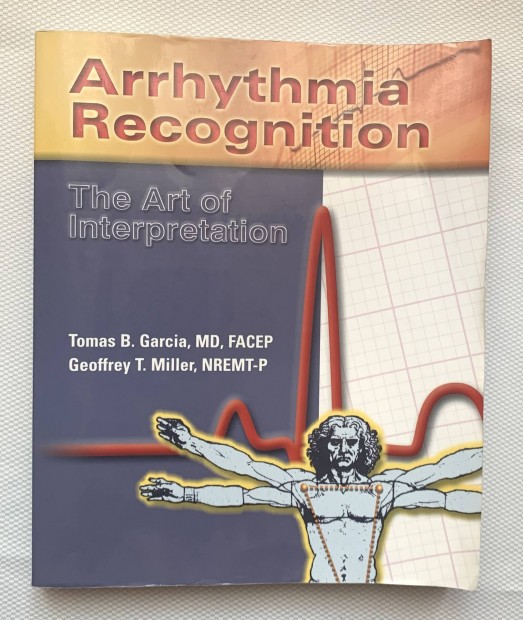 Arrhythmia Recognition: The Art of Interpretation (orvosi szakknyv) 