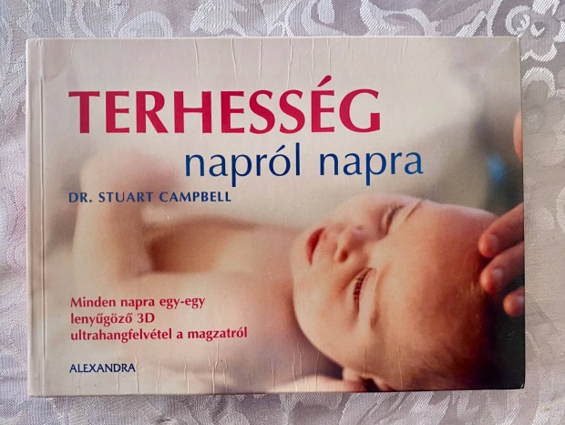 Dr. Stuart Campbell: Terhessg naprl napra