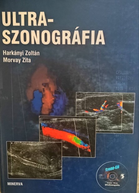 Harkny Zoltn: Ultra-Szonogrfia CD-vel