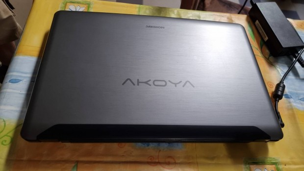 Medion Akoya 17,3 Laptop