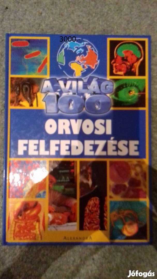 A világ 100 orvosi felfedezése