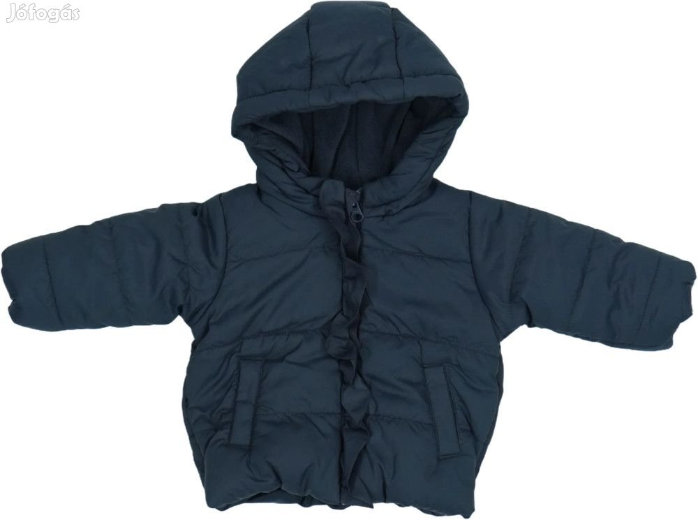 Benetton Új (címkés) Lány Télikabát (Méret: 62)