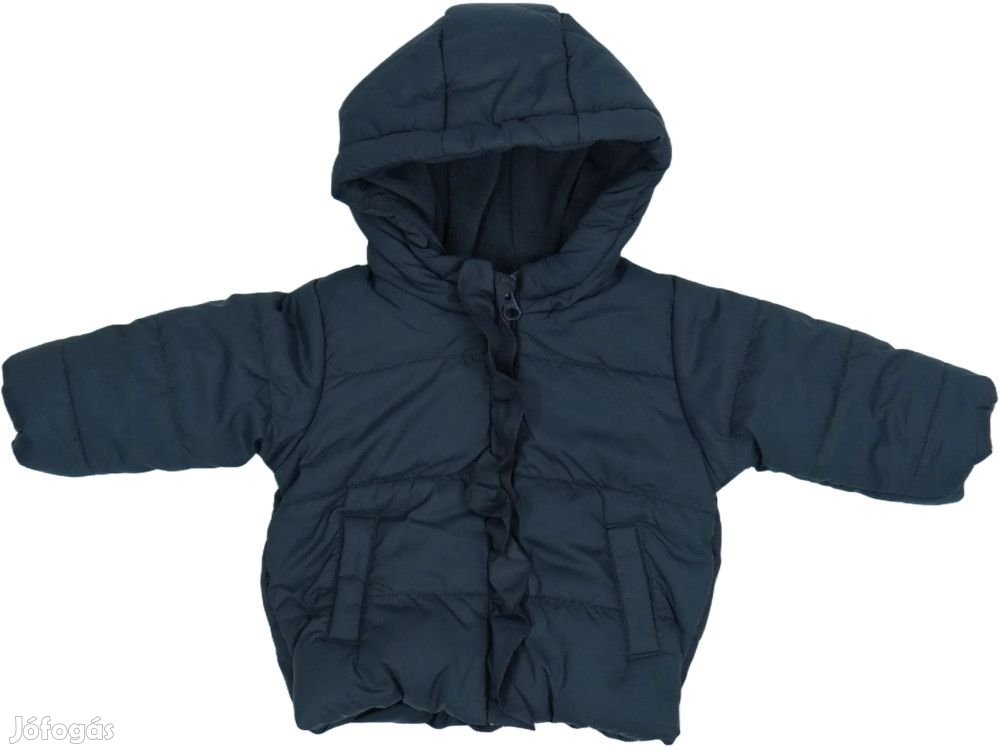 Benetton Új (címkés) Lány Télikabát (Méret: 62)