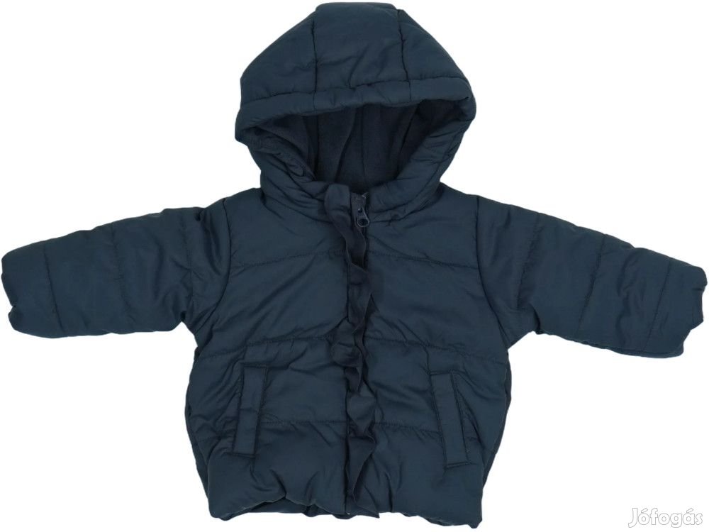 Benetton Új (címkés) Lány Télikabát (Méret: 62)