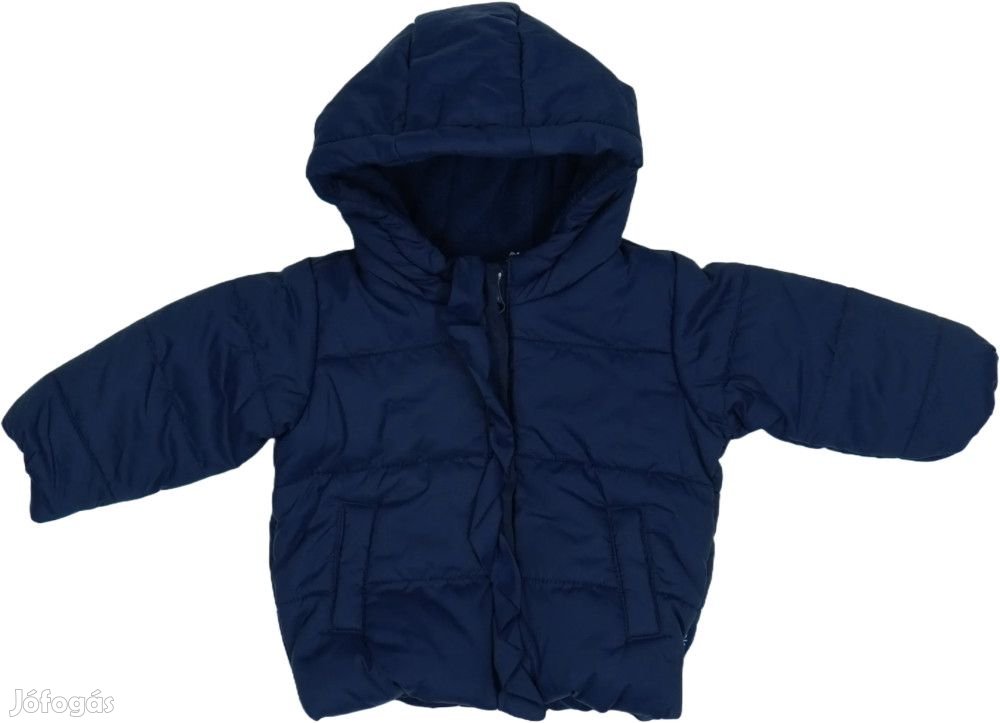 Benetton Új (címkés) Lány Télikabát (Méret: 62)