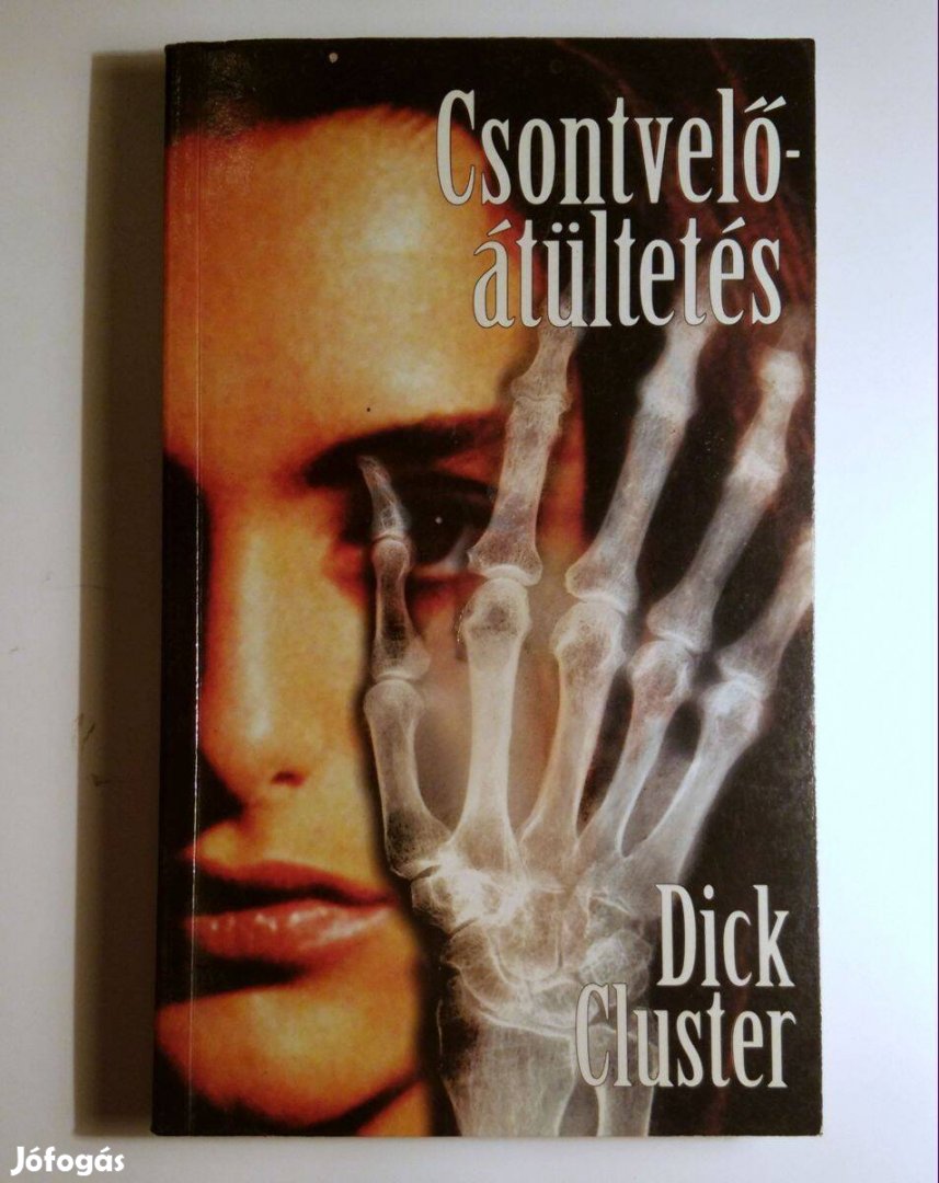 Csontvelő-átültetés (Dick Cluster) 1997 (8kép+tartalom)