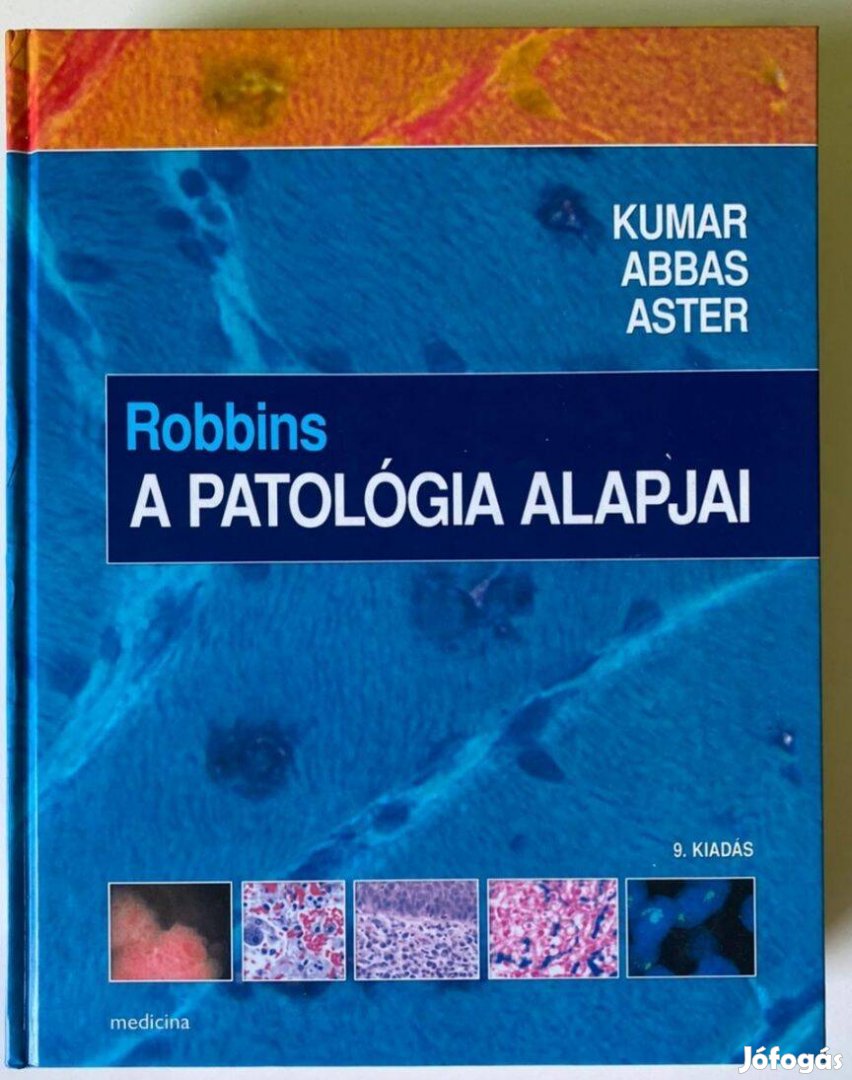 Eladó Robbins : A patológia alapjai