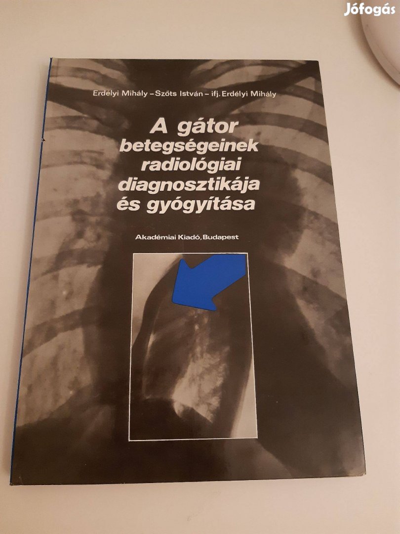 Erdélyi:A gátor betegségeinek radiológiai diagnosztikája és gyógyítása