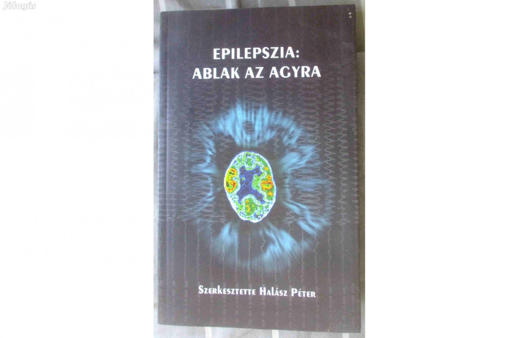 Halász Péter: Epilepszia: Ablak az agyra