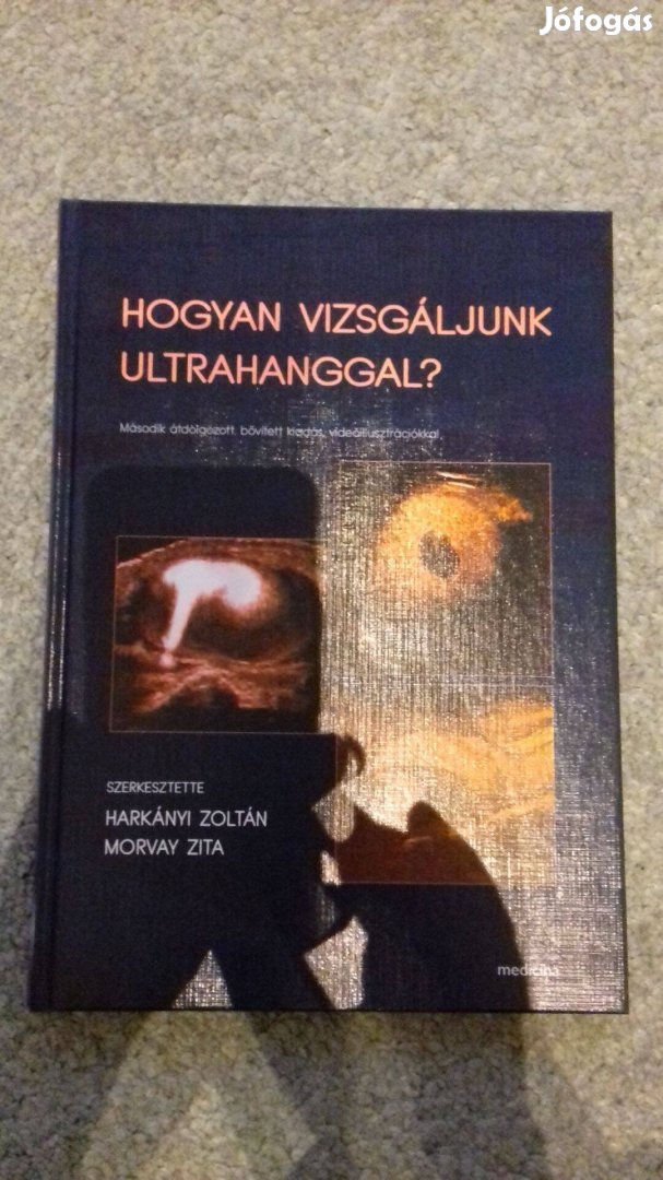 Harkányi: Hogyan vizsgáljunk ultrahanggal?