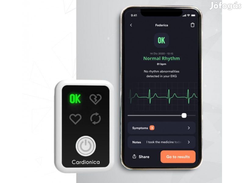 Hordozható EKG Cardionica, hordható aritmiaszűrő