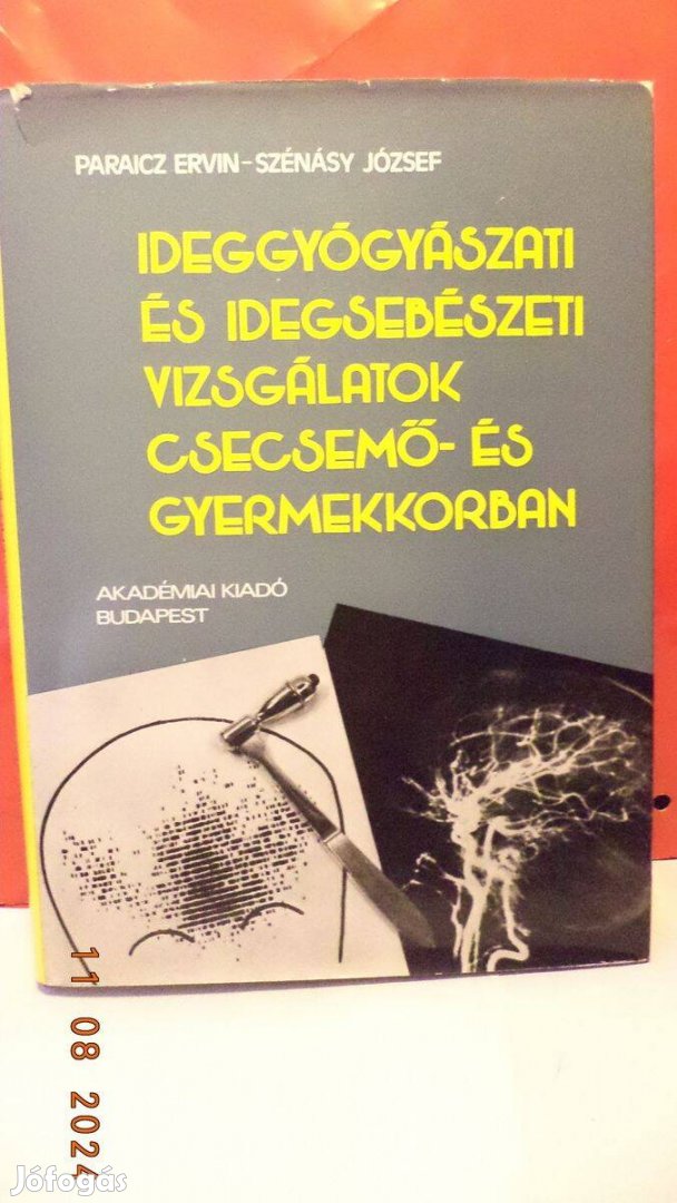 Ideggyógyászati és idegsebészeti vizsgálatok csecsemő . korban