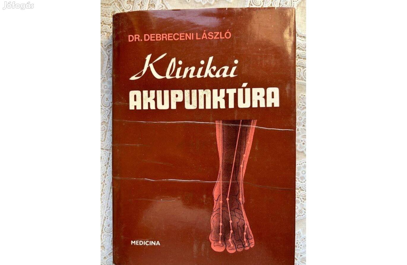 Klinikai Akupunktúra
