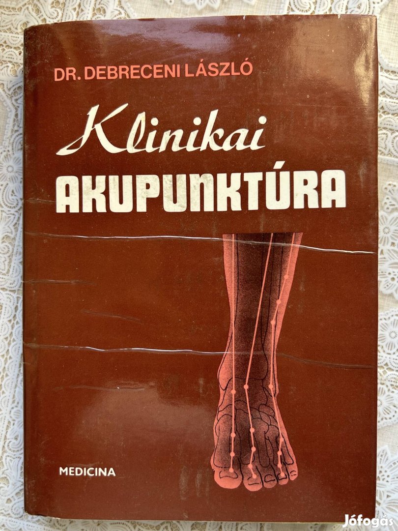 Klinikai Akupunktúra