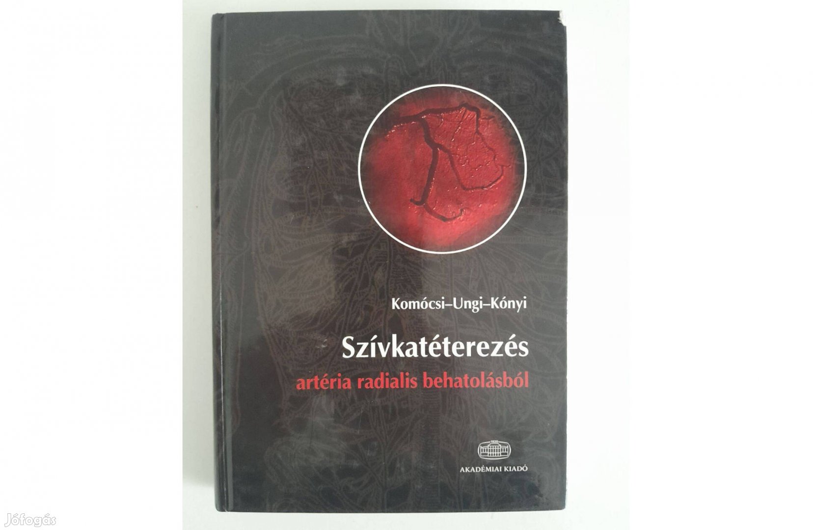 Kónyi Attila Szívkatéterezés artéria radialis behatolásból