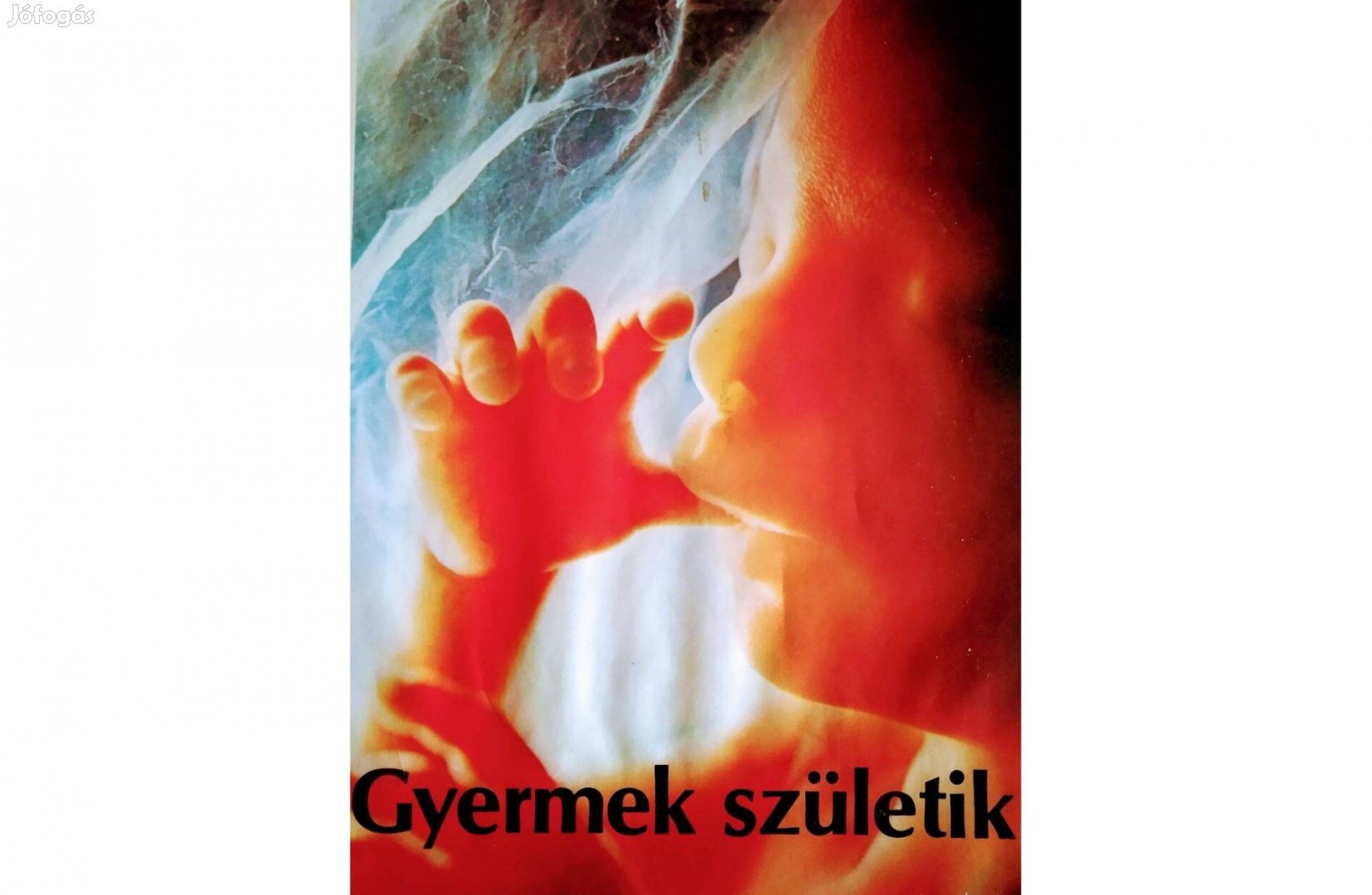 L. Nilsson L. Hamberger Gyermek születik Medicina
