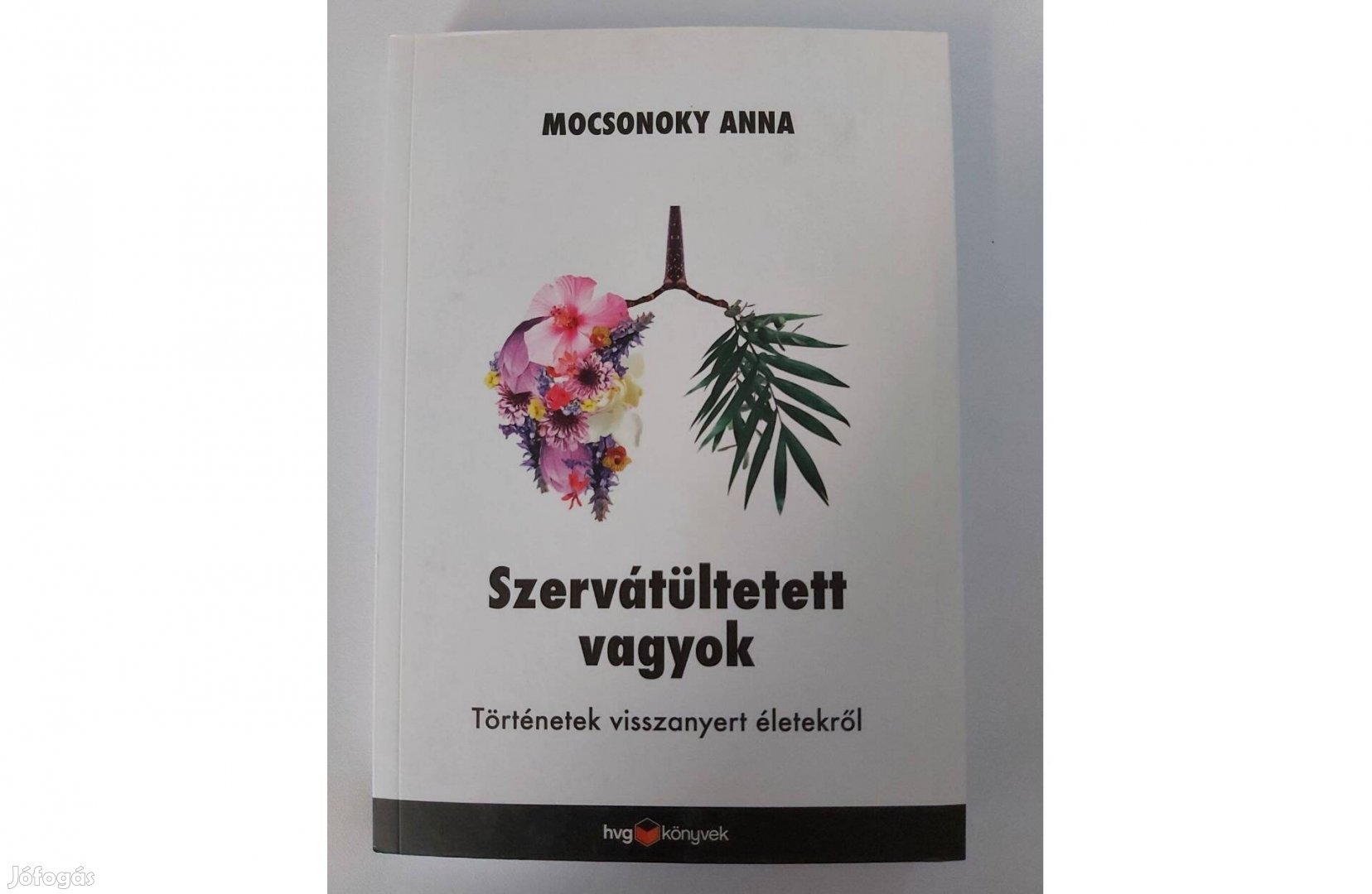 Mocsonoky Anna: Szervátültetett vagyok