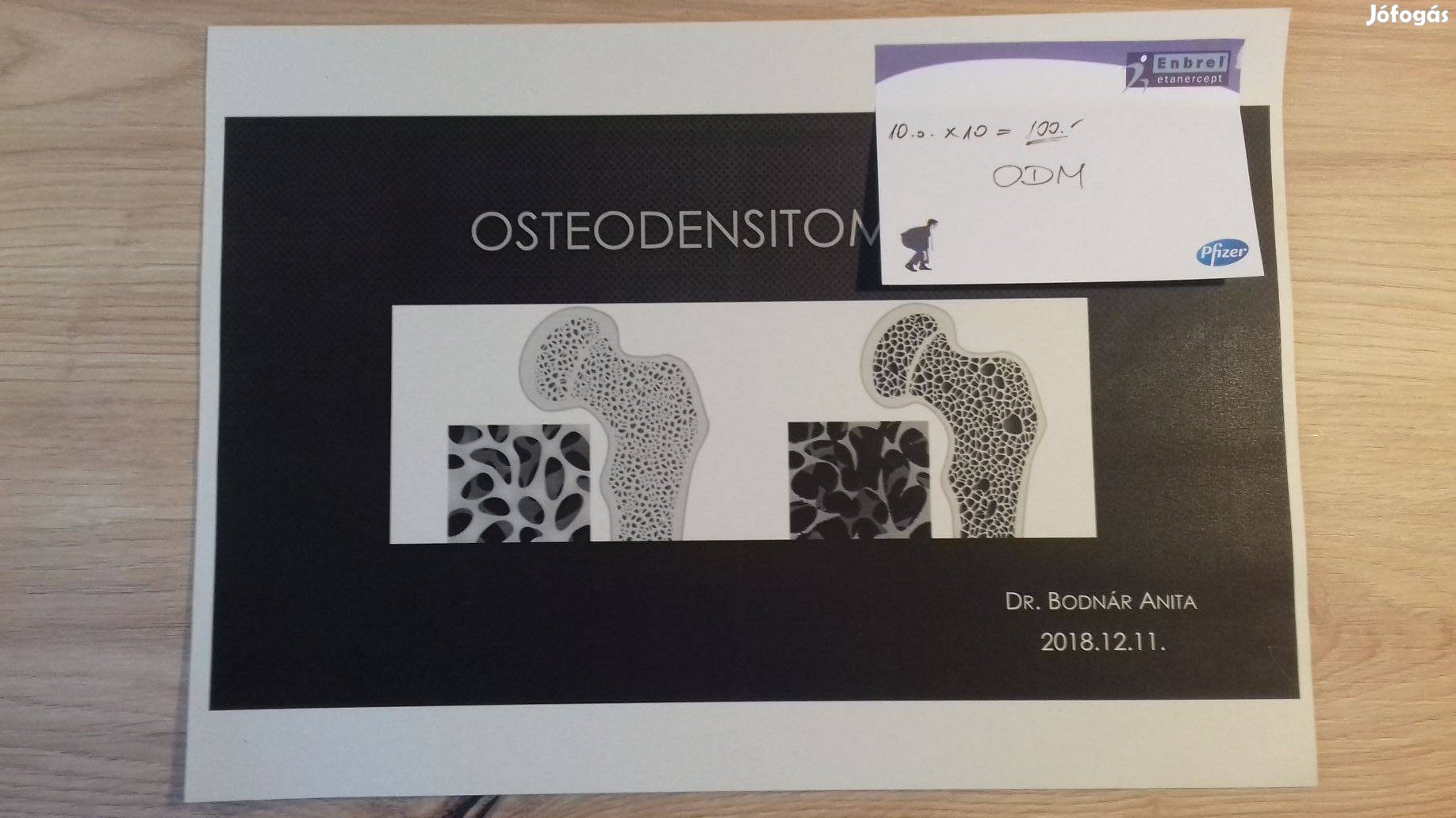 ODMDEXA csontsűrűség mérés jegyzet