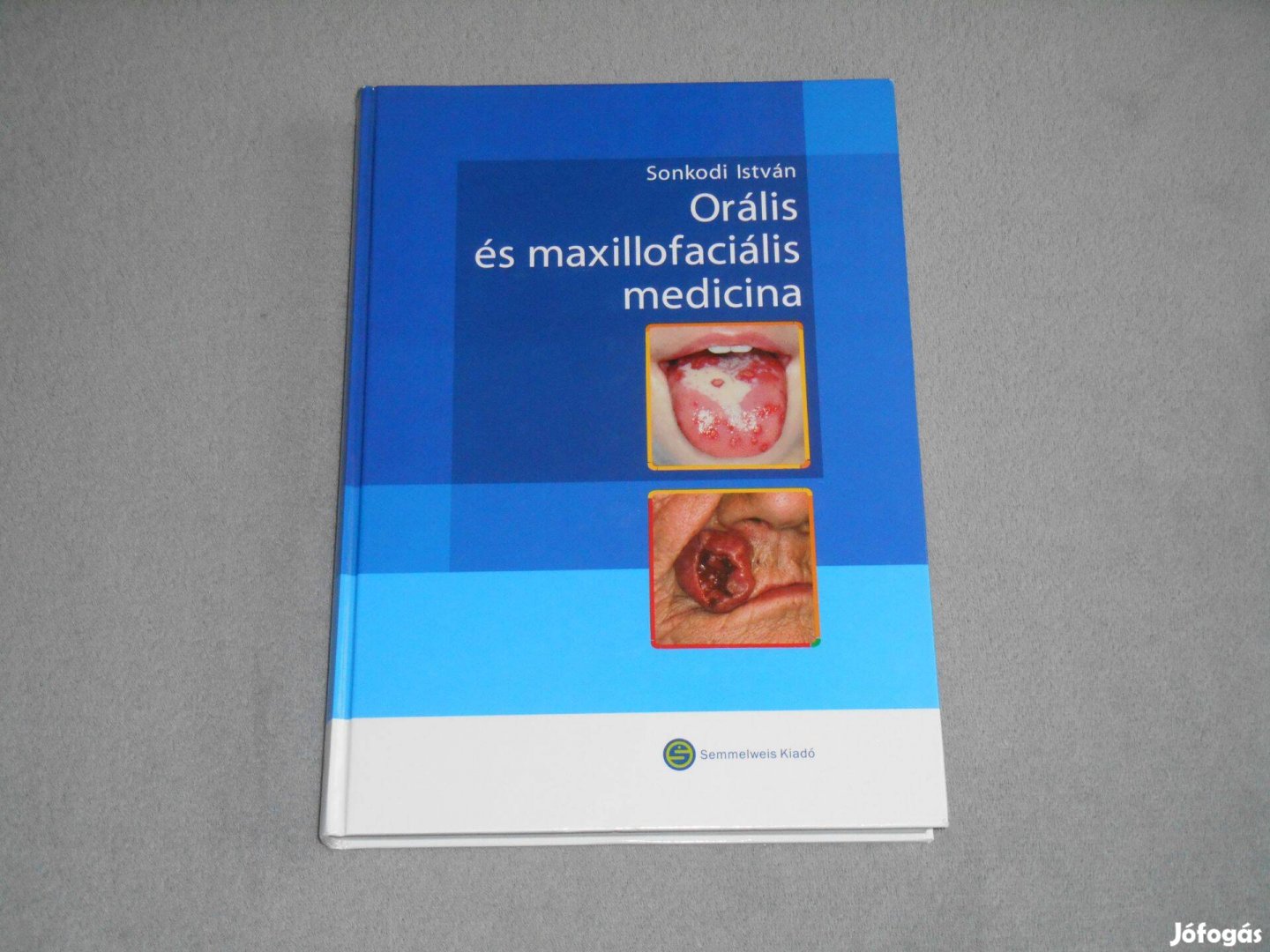 Orális és maxillofaciális medicina - Sonkodi István (Nagyon ritka!)