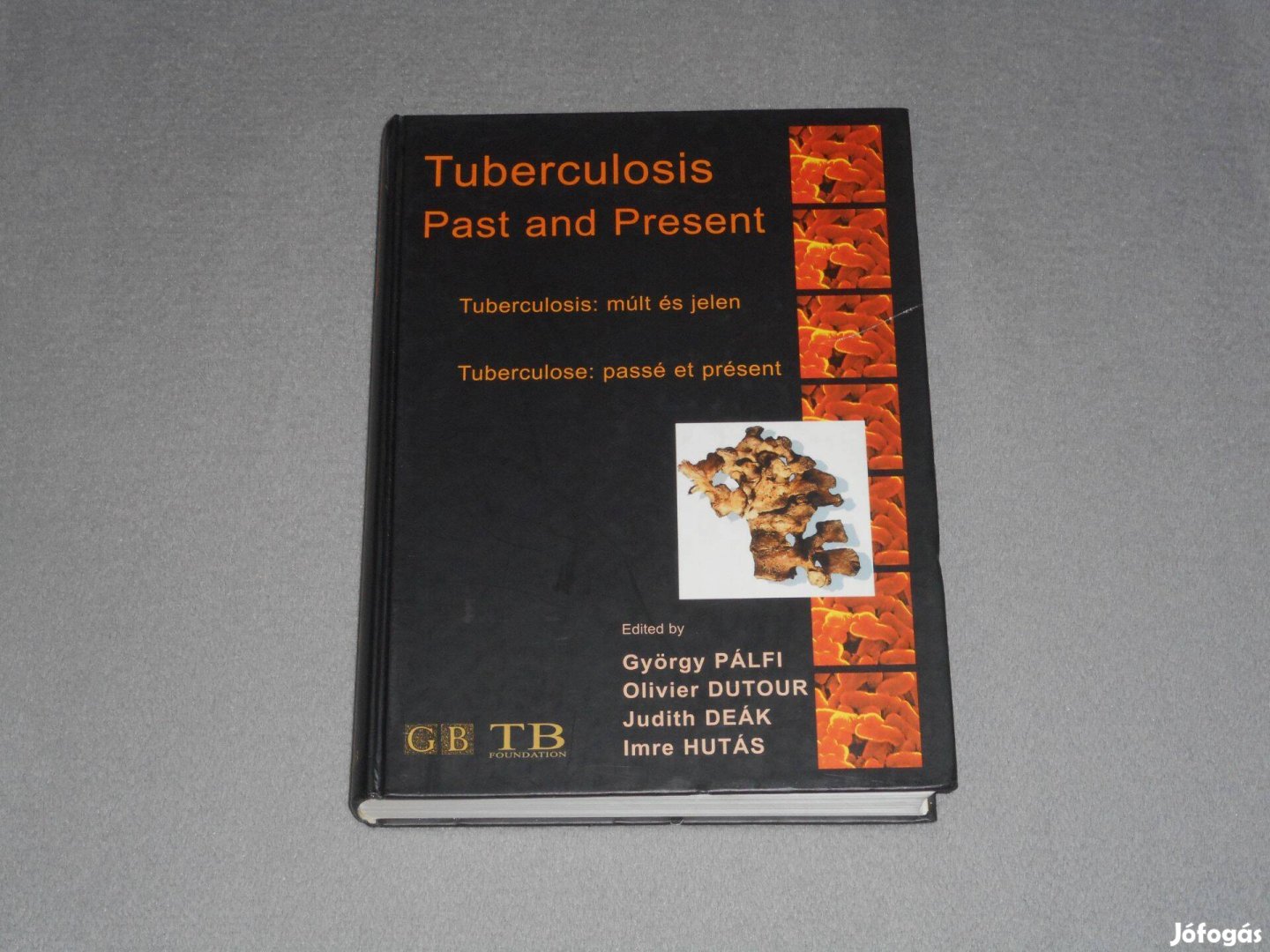 Pálfi György - Tuberculosis múlt és jelen / Past and Present