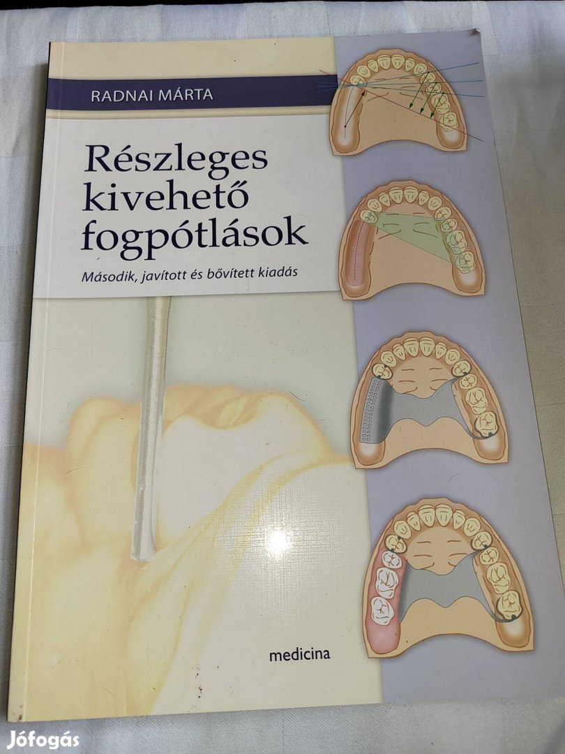 Radnai Márta: Részleges kivehető fogpótlások
