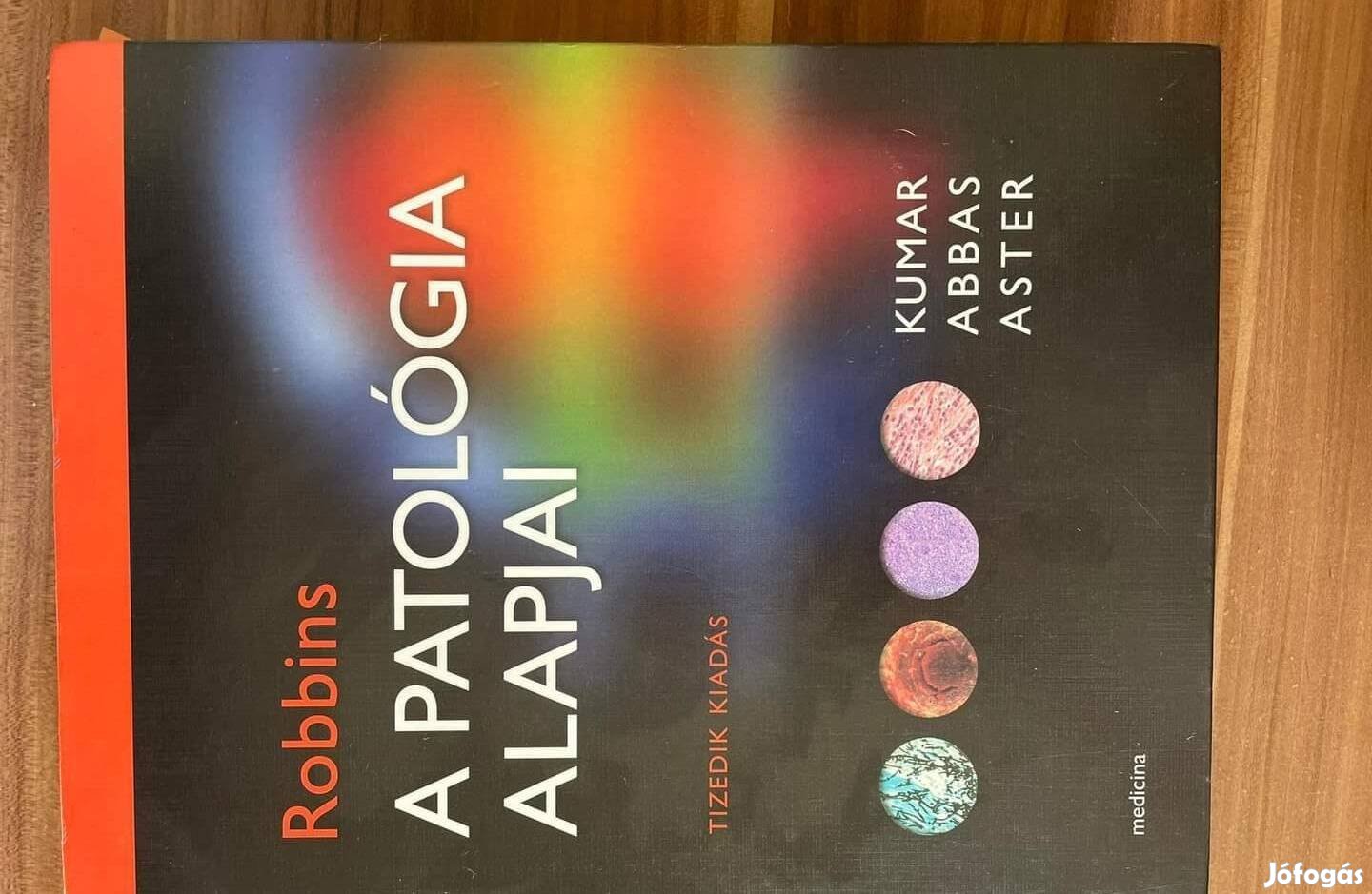 Robbins Patologia alapjai