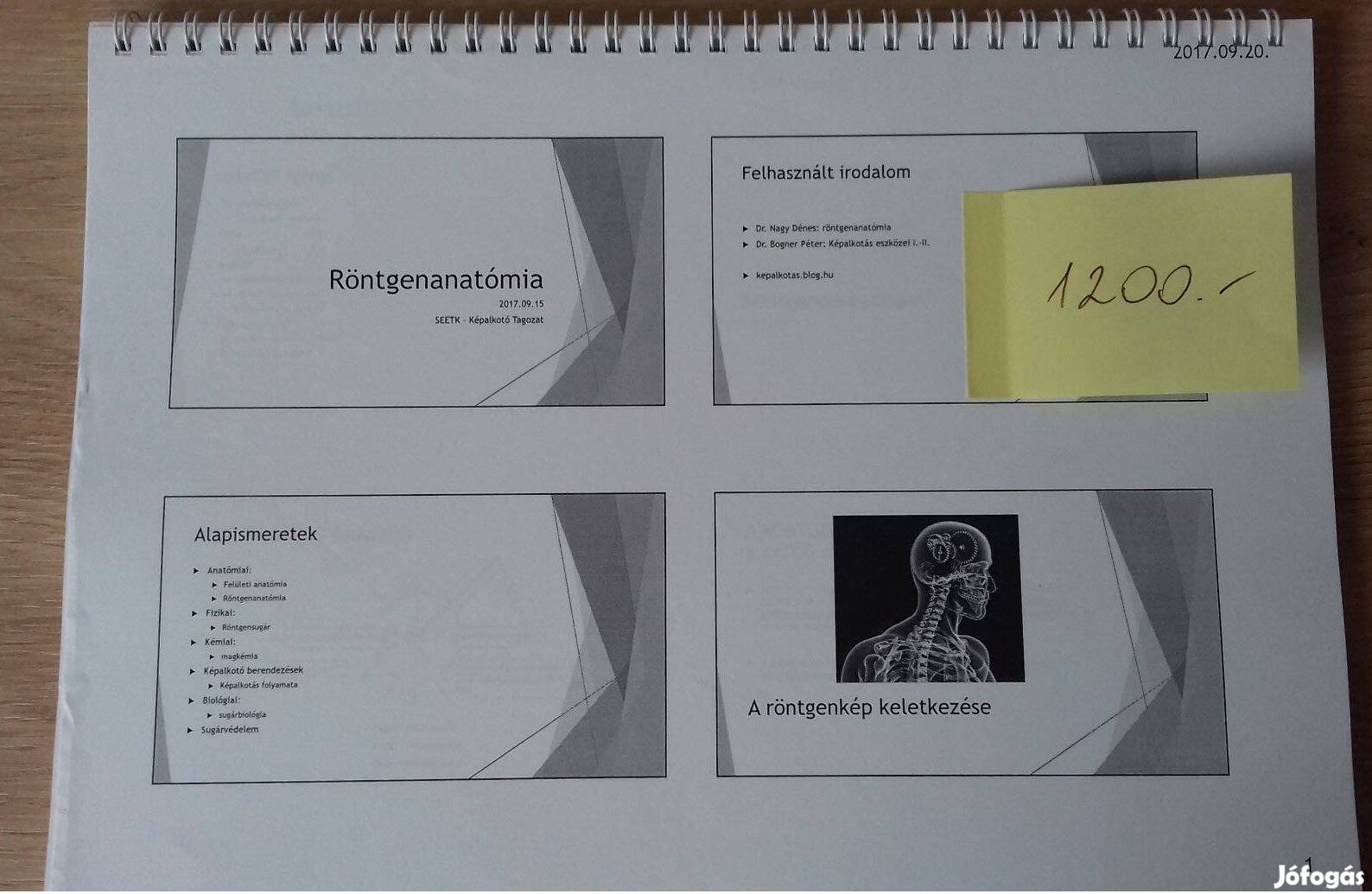 Röntgenanatómia képalkotó diagnosztikai analitika