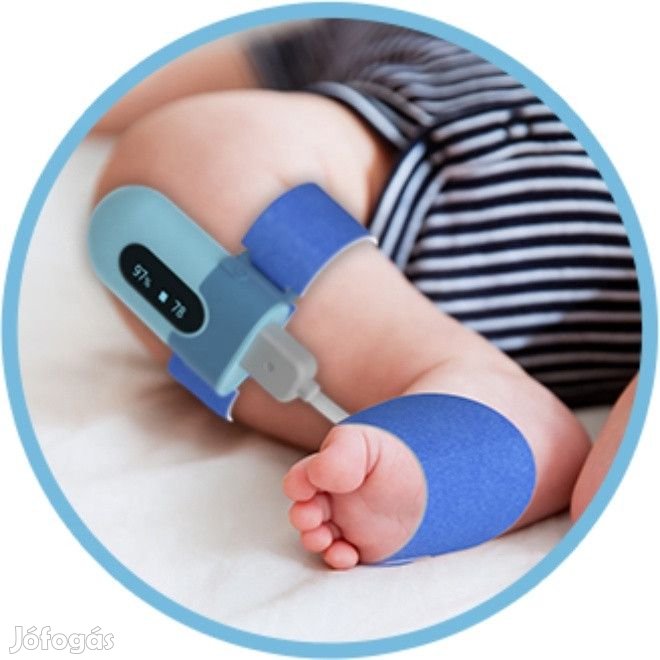 Viatom Baby véroxigénszintmérő készülék, csecsemő pulzoximéter