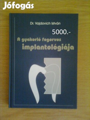 A gyakorló fogorvos implantológiája