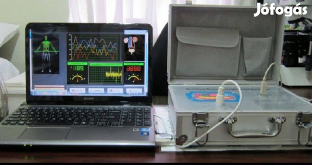 Állapotfelmérő biorezonanciás készülék