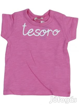 Benetton Új (címkés) Lány Póló (Méret: 56)