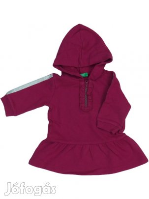 Benetton Új (címkés) Lány Ruha (Méret: 68)