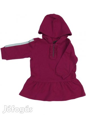 Benetton Új (címkés) Lány Ruha (Méret: 80)