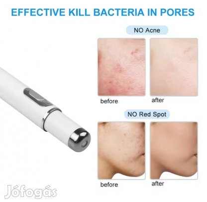 Börhiba gyógyító kék fény