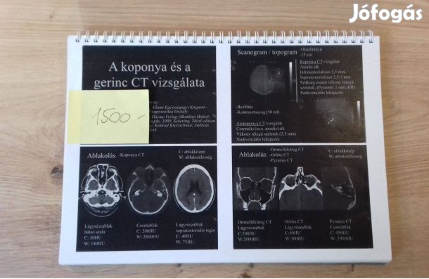 CT vizsgálati paraméterek, CT patológia