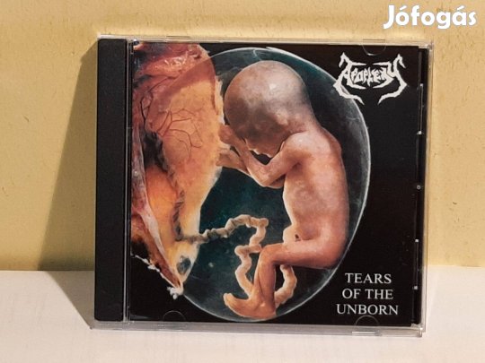 Cd Apoplexy Tears Of The Unborn