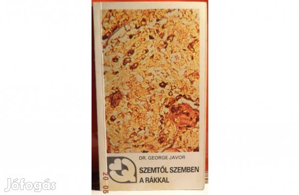 Dr. George Javor: Szemtől szemben a rákkal