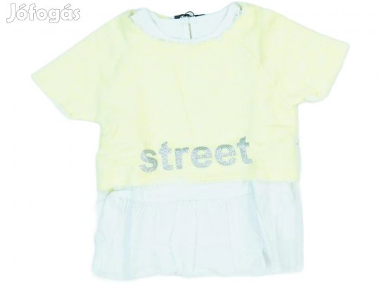 GF Ferré Új (címkés) Lány 2 részes szett - Felsőruházat (Méret: 80)