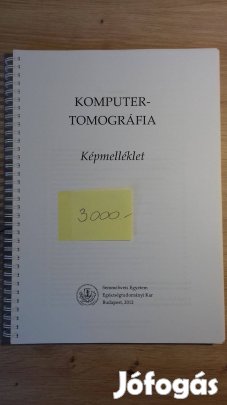 Komputertomográfia Képmelléklet