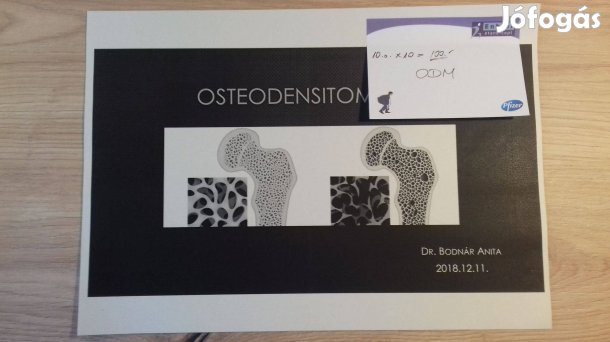 ODM/DEXA (csontsűrűség mérés) jegyzet
