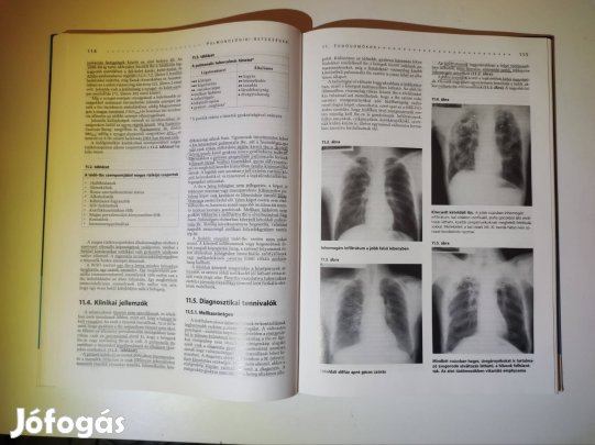 Pulmonológiai betegségek