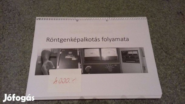 Röntgenképalkotás folyamata