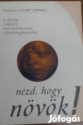 Stuart Campbell : Nézd, hogy növök!
