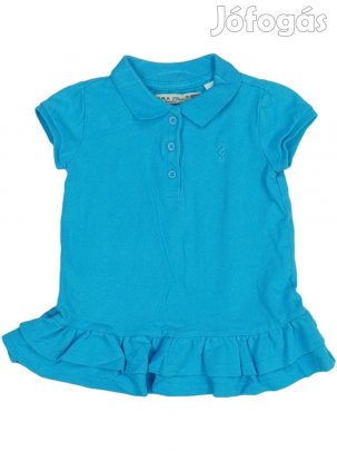 Zara Használt (újszerű) Lány Ruha (Méret: 86)